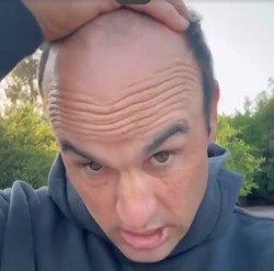 太陽報：前美國國腳多諾萬為脫發(fā)苦惱，向粉絲求助幫忙挑假發(fā)